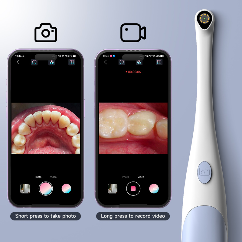 2 in 1 Oral Camera for Type-C/ - Endoscope Inspection Camera 评论和价格